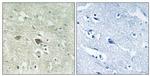 NDUFV3 Antibody in Immunohistochemistry (Paraffin) (IHC (P))