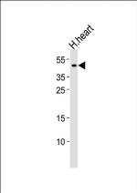 NDUFV3 Antibody in Western Blot (WB)