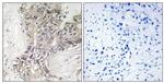 B3GALTL Antibody in Immunohistochemistry (Paraffin) (IHC (P))