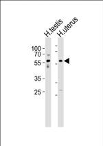 B3GALTL Antibody in Western Blot (WB)