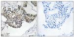 RSAD1 Antibody in Immunohistochemistry (Paraffin) (IHC (P))