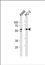 RSAD1 Antibody in Western Blot (WB)