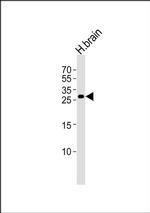 RIM4 Antibody in Western Blot (WB)