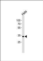 APOA1BP Antibody in Western Blot (WB)