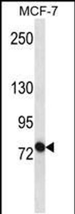 ABCB10 Antibody in Western Blot (WB)