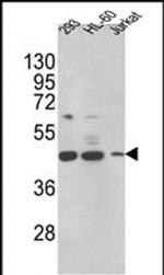 HSD17B7 Antibody in Western Blot (WB)