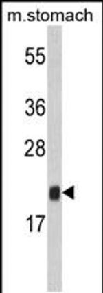 FKBP11 Antibody in Western Blot (WB)