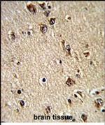 ALAD Antibody in Immunohistochemistry (Paraffin) (IHC (P))