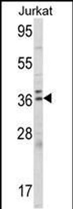 ALAD Antibody in Western Blot (WB)