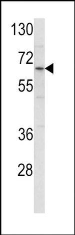 ENTH Antibody in Western Blot (WB)