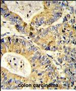 RPS18 Antibody in Immunohistochemistry (Paraffin) (IHC (P))
