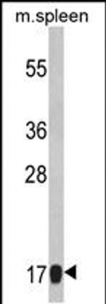 RPS18 Antibody in Western Blot (WB)