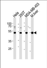 GSS Antibody in Western Blot (WB)