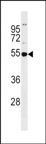 GSS Antibody in Western Blot (WB)