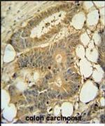 EPS8L3 Antibody in Immunohistochemistry (Paraffin) (IHC (P))