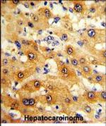 RPS15 Antibody in Immunohistochemistry (Paraffin) (IHC (P))