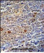 C9orf156 Antibody in Immunohistochemistry (Paraffin) (IHC (P))