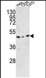 C9orf156 Antibody in Western Blot (WB)