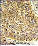RGP1 Antibody in Immunohistochemistry (Paraffin) (IHC (P))