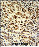 HMHA1 Antibody in Immunohistochemistry (Paraffin) (IHC (P))