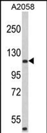 HMHA1 Antibody in Western Blot (WB)