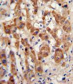 NAT2 Antibody in Immunohistochemistry (Paraffin) (IHC (P))