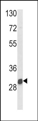 NAT2 Antibody in Western Blot (WB)