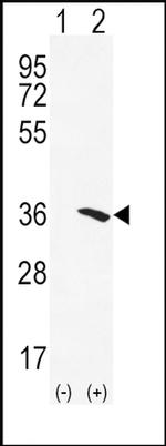NAT2 Antibody in Western Blot (WB)