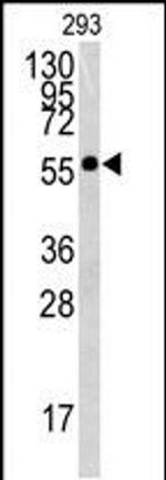 BTBD1 Antibody in Western Blot (WB)