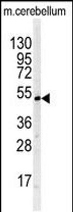 BTBD1 Antibody in Western Blot (WB)