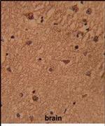 BABAM1 Antibody in Immunohistochemistry (Paraffin) (IHC (P))