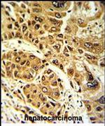 LPIN2 Antibody in Immunohistochemistry (Paraffin) (IHC (P))