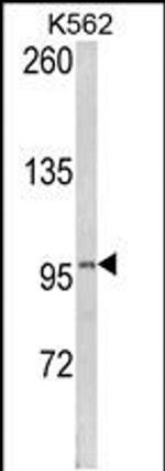 LPIN2 Antibody in Western Blot (WB)