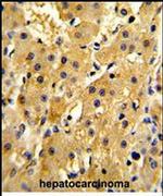 HPD Antibody in Immunohistochemistry (Paraffin) (IHC (P))