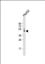 HPD Antibody in Western Blot (WB)