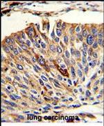 VTI1A Antibody in Immunohistochemistry (Paraffin) (IHC (P))