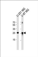 VTI1A Antibody in Western Blot (WB)