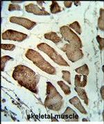 LMOD1 Antibody in Immunohistochemistry (Paraffin) (IHC (P))