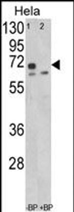 LMOD1 Antibody in Western Blot (WB)