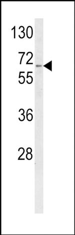 CYP4F3 Antibody in Western Blot (WB)