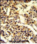 CYP2A13 Antibody in Immunohistochemistry (Paraffin) (IHC (P))