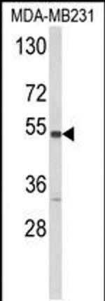 CYP2A13 Antibody in Western Blot (WB)