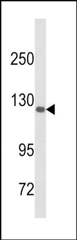 DSC1 Antibody in Western Blot (WB)