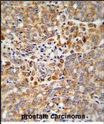 ALKBH3 Antibody in Immunohistochemistry (Paraffin) (IHC (P))