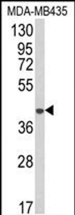 AGPAT4 Antibody in Western Blot (WB)