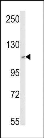 SKIV2L2 Antibody in Western Blot (WB)
