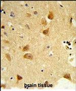 DERL1 Antibody in Immunohistochemistry (Paraffin) (IHC (P))