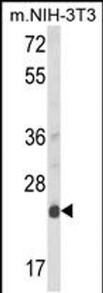 DERL1 Antibody in Western Blot (WB)