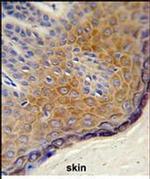 DERA Antibody in Immunohistochemistry (Paraffin) (IHC (P))