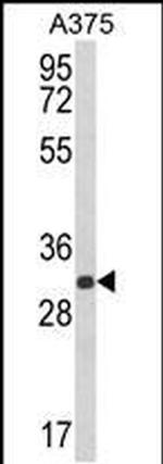 DERA Antibody in Western Blot (WB)